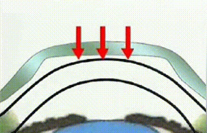 【圣爱眼科为家长答疑解惑】角膜塑形镜为什么能控制近视进展，效果怎么样？