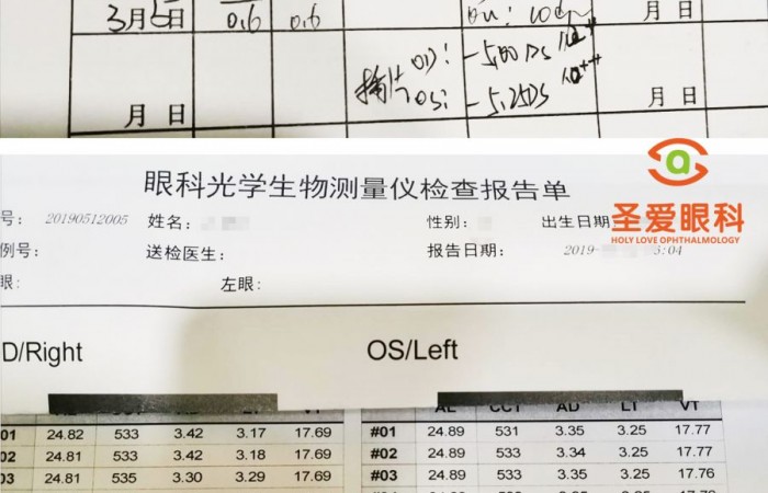 网课持续进行中，孩子的近视度数涨了吗？