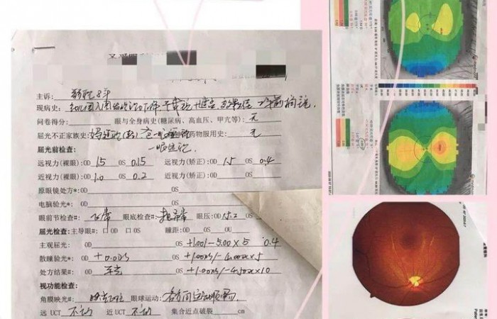 【圣爱眼科弱视案例分享】找对了方法，改变孩子的一生