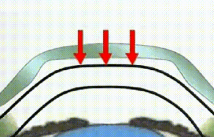 【圣爱眼科为家长答疑解惑】角膜塑形镜应该选择什么品牌？